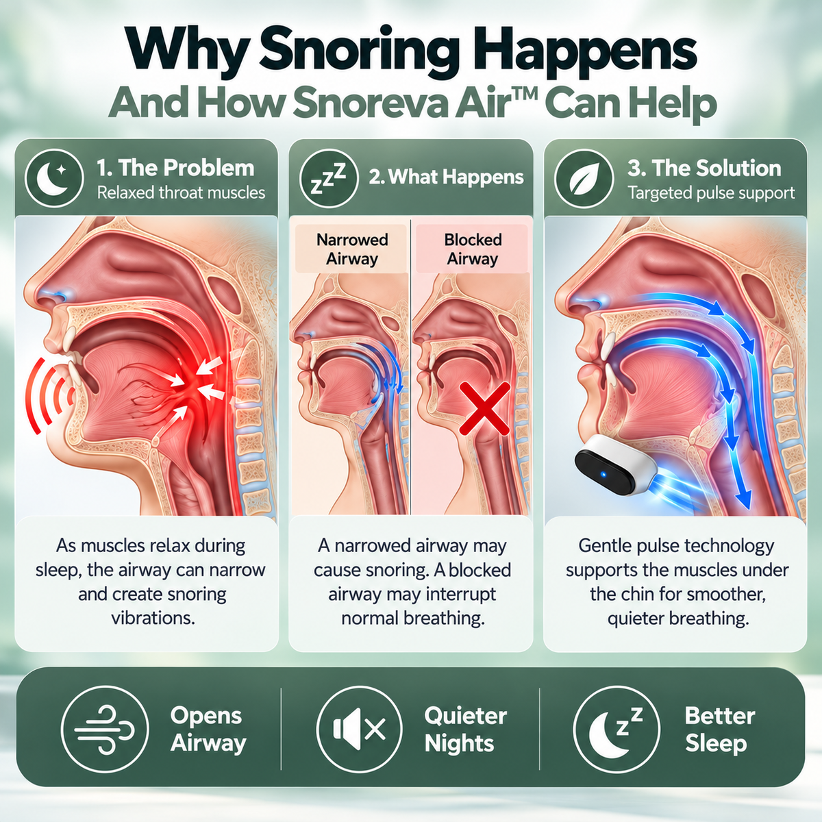 Snoreva Air – Smart Anti-Snore Device